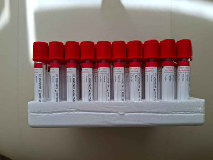 1 Caja 600 Tubos ROJOS, Toma de Muestra, PLAIN TUBE